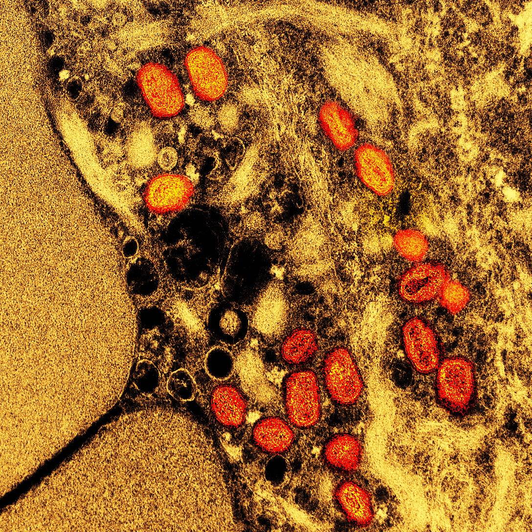 Micrografia eletrônica de transmissão colorida de partículas do vírus mpox capturadas no NIAID